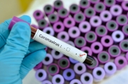 Apiro, 52enne positivo al Coronavirus. Crescono i casi in regione